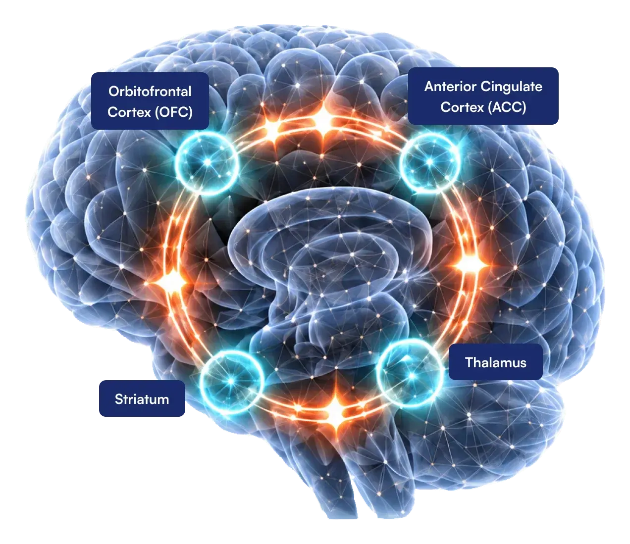 Brain with the orbitofrontal cortex, anterior cingulate cortex, striatum and thalamus labelled